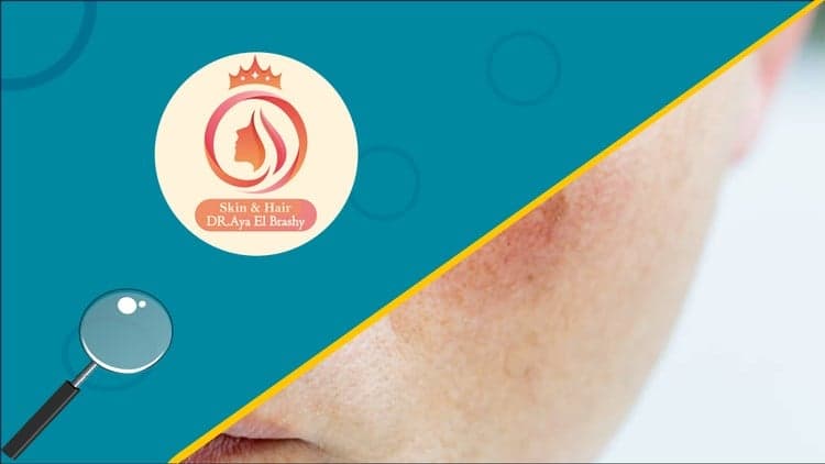 Mastering Sensitive and Damaged Skin - Free Udemy Course 100% Off